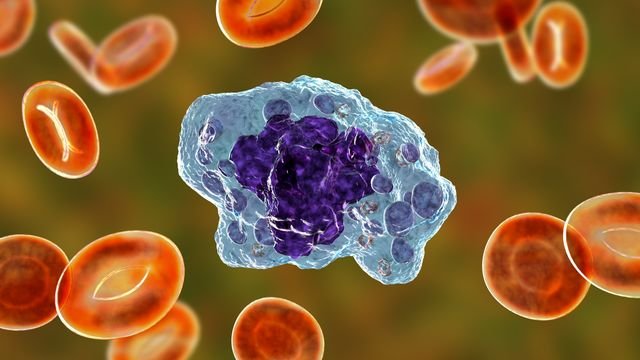 Single-Cell Metabolomics Uncovers Alterations in Cells Infected with TB
