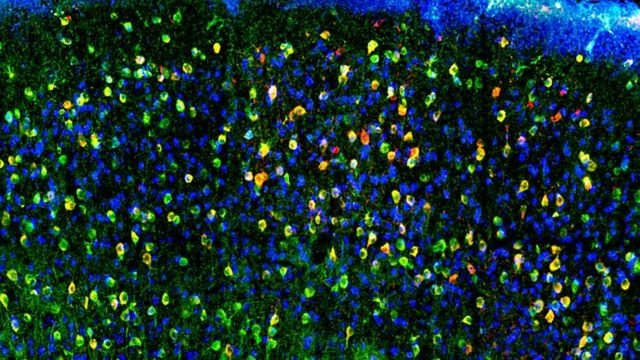 Enhanced Cell Imaging with New Fluorescent Probes
