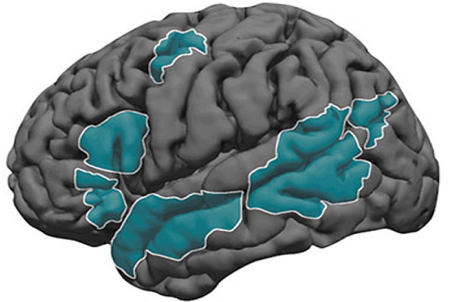 Brain Language Development | MIT News
